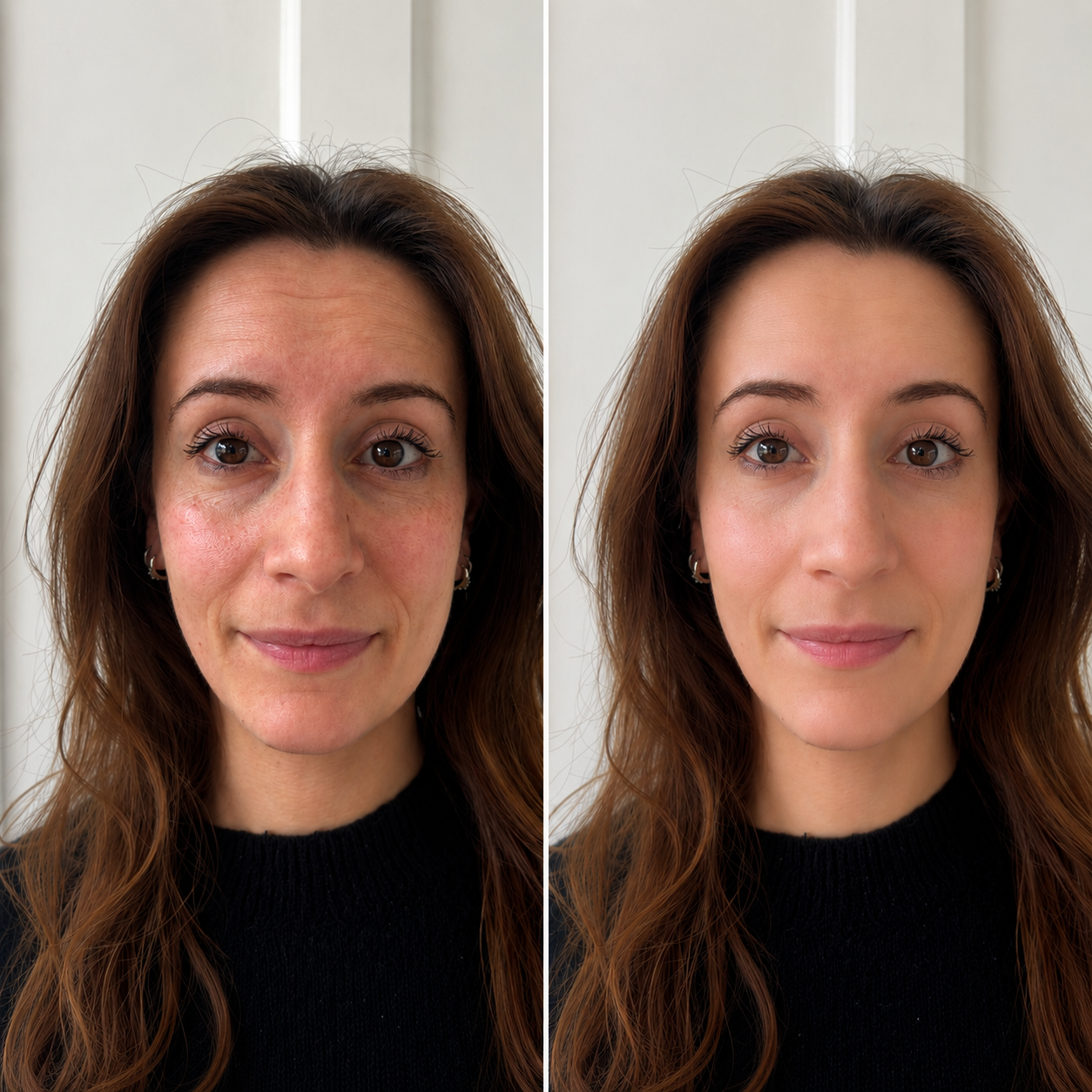 Dermazenic before and after result