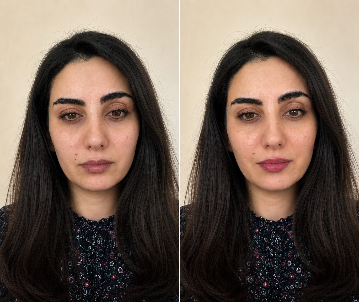 Dermazenic before and after result